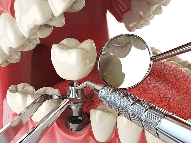 Best Emergency Dental Care for Sports Injuries in Mathews, VA